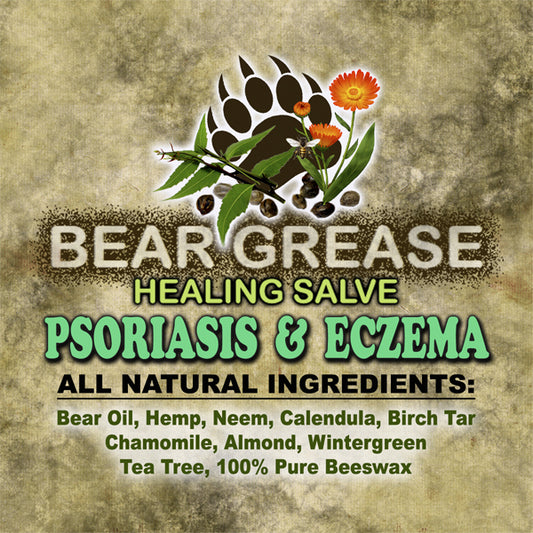 Beargrease Psoriasis/Eczema (Canada Only)